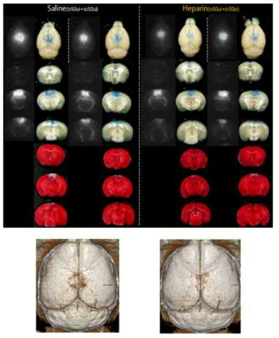 뇌정맥동-혈전증 모델에 heparin pretreatment 24시간 뒤 희생시켜 얻은 전뇌와 절편의 Light, NIRF-cy5.5형광, TTC staining 전, 후의light 사진/ microCT 3D 재구성 imaging
