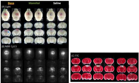 뇌정맥 동-혈전증 유발 24시간째에 dexamethasone/saline(control) 주입 하고 24시간 뒤 희생시켜 얻은 전뇌와 절편의 Light, NIRF - cy 5. 5형광, TTC staining 전, 후의light 사진