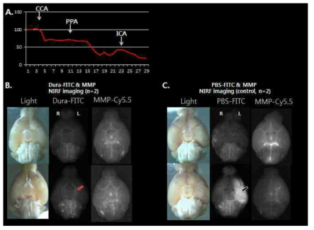 수술시 뇌혈류그래프와 뇌조직의 Dura-FITC와 MMP-Cy5.5 형광 사진