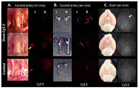 Carotid artery의 intravital microscopy Cy5.5 형광 imaging과 뇌조직의 Cy5.5 형광사진