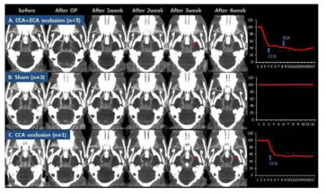 carotid artery 폐색 후 microCT angiography 와 혈류량 변화그래프