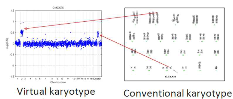 Conventional Karyotyping과 Molecular Karyotyping의 비교