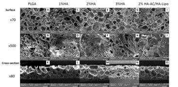 SEM images of HA-coated PLGA scaffolds fabricated in various conditions. (A-J) SEM images of the surfaces of porous PLGA and HA-coated PLGA scaffolds; (K-O) SEM images of the cross-sections of porous PLGA and HA-coated PLGA scaffolds