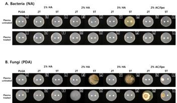 Results of microorganism contamination test in PLGA and HA-coated PLGA scaffolds before and after Plasma treatment. (A) Bacteria contamination test; (B) Fungi contamination test