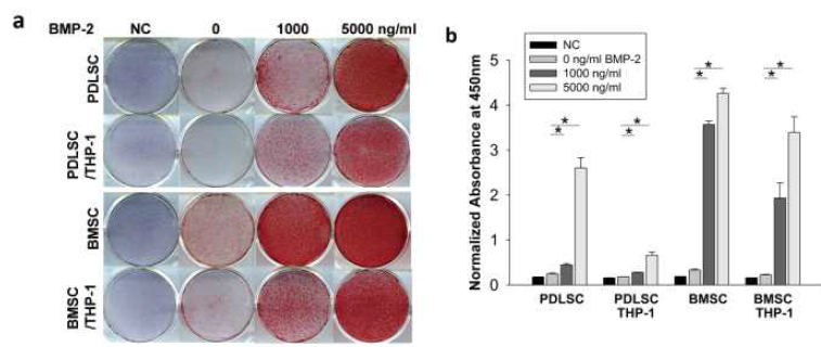 Co-culturing THP-1 cells inhibits late osteogenic differentiation of dental mesenchymal stem cells. (a) Calcium deposits from osteogenic differentiation of both BMSCs and PDLSCs with or without THP-1 cells were stained with alizarin red S solution at day 10. (b) Stained calcium deposits were destained and quantified with 20% methanol and 10% acetic acid. Abbreviations: NC, negative control with no osteogenic differentiation