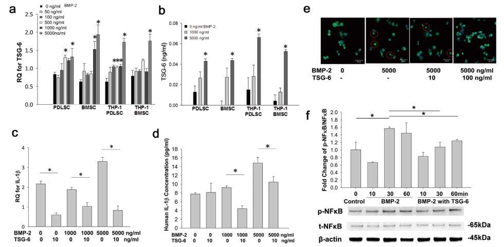 TSG-6 secreted by MSCs in response to BMP-2 induction interferes with inflammatory reactions of THP-1 cells through NF-κB signaling. (a) Real-time RT-PCR revealed that PDLSCs and BMSCs in the presence or absence of THP-1 cells secreted TSG-6 upon BMP-2 treatment for 24 hours, as normalized to GAPDH. (b) The quantitative measurement of human TSG-6 was performed with ELISA kit. The levels of TSG-6 were measured upon BMP-2 treatment for 24 hours. (c, d) Real-time analysis and ELISA showed that TSG-6 inhibited IL-1β expression in THP-1 cells. THP-1 cells were exposed to 50 nM PMA for 3 days and with 1,000 ng/ml or 5,000 ng/ml BMP-2 and 10 ng/ml TSG-6 for 24 hours. (e) Immunofluorescence analysis of NF-κB. THP-1 cells were pre-stimulated with 50 nM PMA and then exposed to BMP-2 for 3 hours in the presence of 10 or 100 ng/ml TSG-6. NF-κB translocation into the nucleus (RED circle) was decreased by TSG-6 treatment. Magnification 200X. Scale bar is 50 μm. (f) Western blots were performed to measure NF-kB phosphorylation. THP-1 cells were stimulated with 50 nM PMA and treated with 5,000 ng/ml BMP-2 or 10 ng/ml TSG-6 for 10, 30, or 60 minutes. Proteins were collected and the ratio of phospho-NF-kB to total NF-kB was determined by immunoblotting