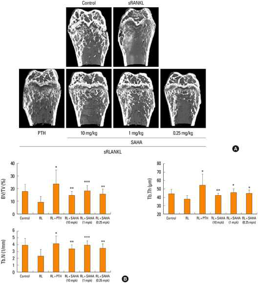 Osteogenic potential associated with suberoylanilide hydroxamic acid (SAHA) in soluble receptor activator of nuclear factor-kappa B ligand (sRANKL)-induced osteoporosis model. ICR mice were treated with various concentrations of SAHA. sRANKL was administered on day 1 and day 2, after which the mice were left untreated until day 4. Starting on day 4, parathyroid hormone (PTH) as the control or various concentrations of SAHA were administered daily until day 13. Mice were sacrificed on day 14. (A) The osteogenic activity of SAHA was assessed with 3-dimensional (3D) micro-computed tomography (CT) image analysis of femurs. (B) Trabecular bones were isolated and bone measurement parameters were enumerated, including bone volume, bone thickness, and bone numbers. Femoral bone volume/total volume (BV/TV), trabecular thickness (Tb.Th), and number of trabecular bones (Tb.N) were measured 0.6 to 1.0 mm proximal to the distal growth plate by histomorphometric analysis