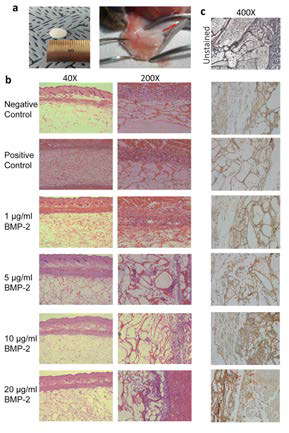 High concentrations of BMP-2 triggered the infiltration of immune cells from blood vessels. (a) Collagen sponge (8 mm diameter, 1 mm thickness) as carriers were transplanted with 1, 5, 10, and 20 μg/ml BMP-2 on the dorsum of mouse. (b) After 24 hours, the inflammatory cells were identified on the swollen soft tissue near implanted collagen sponge with BMP-2 in H & E staining. (c) To detect infiltrated activated macrophages, immunohistochemistry was done by staining with F4/80 antibody. Red arrow indicated activated macrophages (400x)