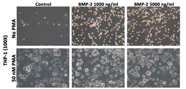 Morphology of THP-1 cells. Without PMA stimulation, THP-1 cells alone cannot be stimulated and attached