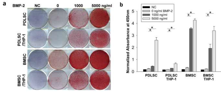 Co-culturing THP-1 cells inhibits late osteogenic differentiation of dental mesenchymal stem cells. (a) Calcium deposits from osteogenic differentiation of both BMSCs and PDLSCs with or without THP-1 cells were stained with alizarin red S solution at day 10. (b) Stained calcium deposits were destained and quantified with 20% methanol and 10% acetic acid. Abbreviations: NC, negative control with no osteogenic differentiation