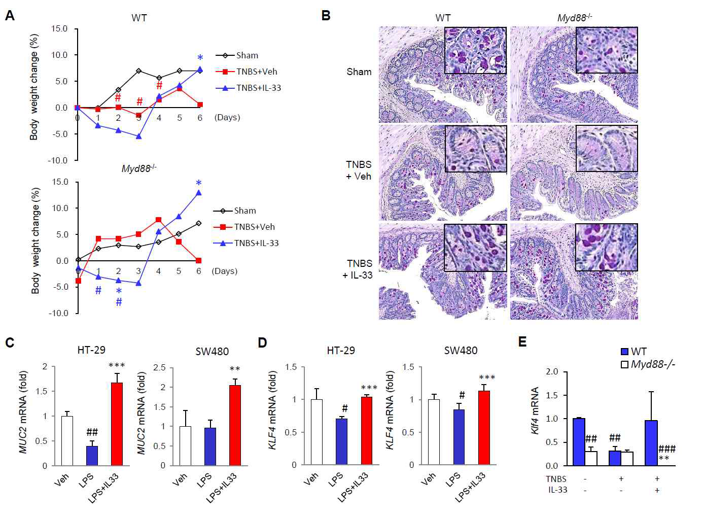 MyD88 independent effects of IL-33 on goblet cell restoration in inflammation. (A, B, E) Effects of IL-33 on colitis and goblet cells in the colon of wild-type (WT) and MyD88 deficient (MyD88-/-)mice after low-dose 2,4,6-trinitrobenzenesulfonic acid (TNBS) administration (n = 5 mice/group). To assess the effects of IL-33 on enterocyte early in colitis, 100 μl TNBS solution (1.8% (w/v)) in 40% ethanol was injected into the colon of each mouse. (A) Changes in body weight. The weight of each mouse was followed daily. (B) Representative image of periodic acid-Schiff (PAS) staining of the colonic mucosa for goblet cells. Original magnification: ×200. (C, D) Effects of IL-33 on MUC2 (C) and KLF4 (D) mRNA expression in human colonic epithelial cells. HT-29 cells were treated with vehicle (Veh) or lipopolysaccharide (LPS, 100 ng/ml), with or without human recombinant IL-33 (hrIL-33), for 4 hours. Total RNA was extracted and analysed by quantitative RT-PCR. Target mRNA expression levels were normalised to that of β-actin. Results are representative of two independent experiments. (E) Effects of IL-33 on Klf4 mRNA expression in the mouse colon. Values are expressed as means; error bars represent ±SD. #P < 0.05 vs. Sham control, *P < 0.05 vs. TNBS or LPS, **P < 0.01 vs. TNBS or LPS, ***P < 0.005 vs.LPS as assessed by ANOVA. Veh, injected with vehicle; IL-33, injected with mrIL-33 (1μg /mouse) or hrIL-33 (20 ng/ml); TNBS, injected with TNBS