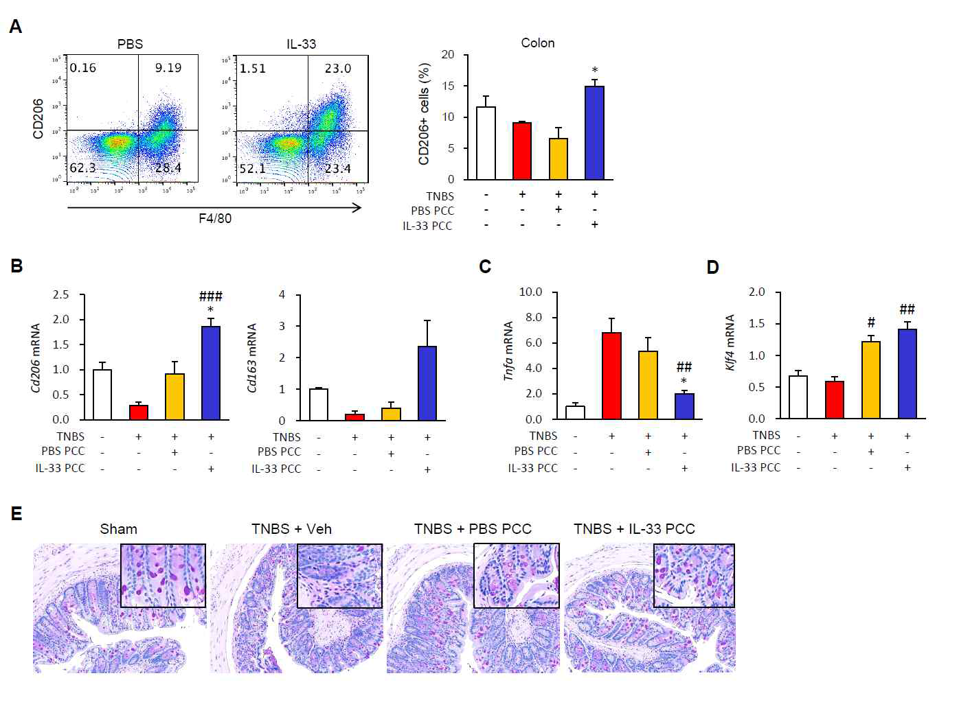 IL-33-treated peritoneal cavity cells rescue M2 macrophages and the goblet cells in colon tissues with colitis. (A) Representative flow cytometry plots of M2 (CD206+) macrophage (F4/80+) populations in colon samples. (B-D) Effects of IL-33 on the mRNA expression levels of M2 (Cd206 and Cd163, B), M1 marker (Tnfa, C), and goblet cell marker (Klf4, D) in the colons. (E) Representative periodic acid-Schiff (PAS) staining of colonic mucosal samples. Original magnification: ×200. Values are expressed as means (n = 5); error bars represent ±SDs. *P < 0.05 vs. PBS PCC as assessed by ANOVA. PCC, peritoneal cavity cell; Veh, injected with vehicle; IL-33, injected with mrIL-33; TNBS, injected with TNBS