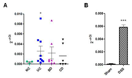 IL-33 mRNA expression in inflamed mucosal tissue samples. (A) Colonic biopsy samples were harvested from noninflamed areas of normal control (NC, n = 3) patients and from inflamed areas of patients with UC (n = 9), BD (n = 7), and CD (n =6). Total RNA was extracted and processed for quantitative RT-PCR. IL-33 expression levels were normalised to that of β-actin. Relative mRNA levels were calculated using the 2DCt formula. The significance of differences between groups was analysed using Student’s t-test. (B) Effects of IL-33 on dextran sodium sulfate (DSS)-induced colitis in mice (n = 5 mice/group). *P < 0.05 vs. NC, *P < 0.05 vs. Sham. NC, normal control; UC, ulcerative colitis; BD, Behçet’s disease; CD, Crohn’s disease; Veh, injected with vehicle; IL-33, injected with mrIL-33; TNBS, injected with 2,4,6-trinitrobenzenesulfonic acid