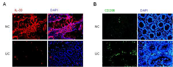 Representative image of CD206 and IL-33 immunostain in human colon (NC, n = 3; UC, n = 4). (A) CD206 immunostaining (green). (B) IL-33 immunostaining (red). Nuclei were counterstained with DAPI (blue). NC, normal control; UC, ulcerative colitis