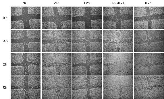 Wound healing assay. Monocytes were isolated from PBMCs and differentiated into macrophages for 7 days. Macrophages were cocultured with the HT-29 cells and wound healing assays were performed. Representative images show increased wound closures by IL-33 treatment. Data are presented as means ±SD (n = 2). *P < 0.05 vs. Veh as assessed by Student’s t-test. NC, not cocultured; Veh, treated with vehicle; IL-33, treated with hrIL-33; LPS, treated with lipopolysaccharide. *P < 0.05 vs. LPS