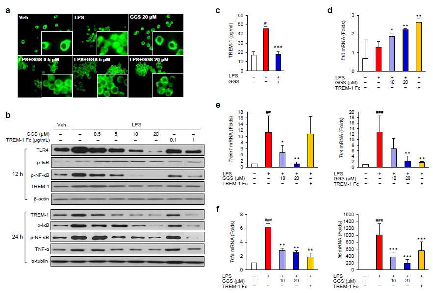 The effects of guggulsterone on NF-κB p65 and TLR4 signalling and the expression of TREM-1. (a) Effects of guggulsterone on NF-κB p65 nuclear translocation. NF-κB p65 (green colour) nuclear translocation was analysed by immunofluorescent (IF) staining. Figures are representative of 2 independent experiments (original magnification ×400). (b) Levels of TLR4, TREM-1, TNF-α, and β-actin and phosphorylation of NF-κB p65 (p-NF-κB) and IκB-α (p-IκB-α) were analysed using Western blotting. Blots are representative of 3 independent experiments. (c) Secreted levels of TREM-1 protein in culture media were measured by enzyme-linked immunosorbent assay (ELISA). Data represent means ± S.D. values (n = 2). (d-f) mRNA levels of Il10 (d), Trem1 and Tlr4 (e), and Tnfa and Il6 (f). Data represent means ± S.D. values (n = 3-4). RAW264.7macrophage cells were treated with LPS (10 μg/mL) and the indicated concentration or 20 μM of GGS for 24 h for IF staining, Western blot, and ELISA and for 4 h for mRNA measurements. Veh, treated with vehicle; GGS, treated with guggulsterone; LPS, treated with lipopolysaccharide; TREM-1 Fc, treated with TREM-1 Fc chimera antibody (1μg/mL). #p < 0.05 vs. Veh, ##p < 0.01 vs. Veh, ###p < 0.005 vs. Veh, *p < 0.05 vs. LPS,**p < 0.01 vs. LPS, ***p < 0.005 vs. LPS