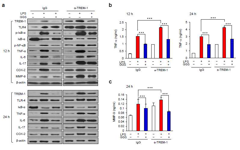 The effects of guggulsterone on amplification of TLR4 signalling by TREM-1 stimulation. (a) Levels of TREM-1, TLR4, IκB-α, TNF-α, IL-6, IL-17, COX-2, MMP-9, and β-actin, and phosphorylation of NF-κB p65 and IκB-α were analysed using Western blotting, which was carried out after 24 h of treatment. Blots are representative of 3 independent experiments. (b) Levels of TNF-α. (c) Levels of MMP-9. Levels of TNF-α and MMP-9 in cultured media were measured by enzyme-linked immunosorbent assay after 12 h or 24 h of treatment. Data represent means ± S.D. values (n = 2). The RAW264.7 cells were pre-treated with GGS (20 μM) and treated with LPS (10 μg/mL) in the presence of IgG or anti-TREM-1 antibody (0.4 μg/mL). α-TREM-1, treated with TREM-1 agonist antibody; GGS, treated with guggulsterone; IgG, immunoglobulin Gisotype control; LPS, treated with lipopolysaccharide. ***p < 0.005 vs. LPS