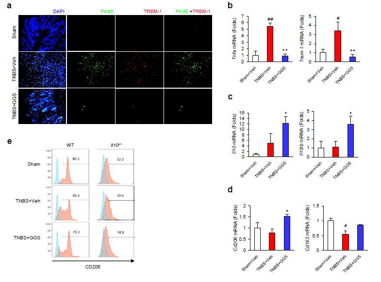 Guggulsterone improves histopathology of TNBS-induced colitis by suppressing TREM-1+ M1 macrophages and increasing M2 macrophages. (a) H GGS, administered with guggulsterone; TNBS, injected with TNBS. #p < 0.05 vs. Veh, ##p < 0.01 vs. Veh, *p < 0.05 vs. TNBS+Veh, **p < 0.01 vs. TNBS+Veh