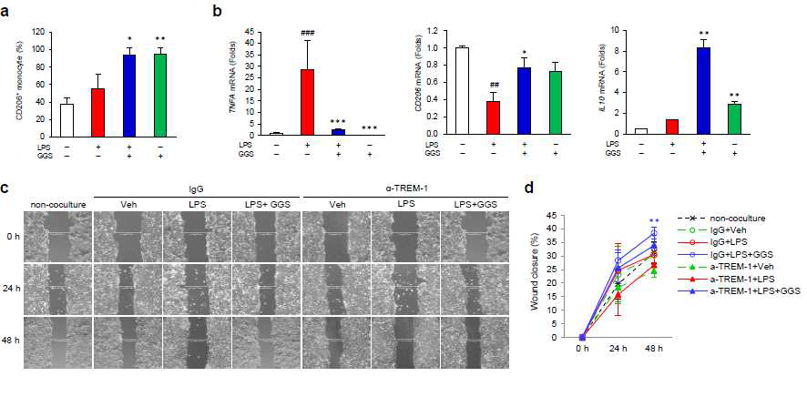 Guggulsterone promotes wound healing by modulating differentiation of human monocytes and macrophages. (a) GGS increases CD206+ cells in human monocytes. Monocytes from the peripheral blood mononuclear cells (PBMCs) of healthy subjects were treated with or without LPS for 4 h after GGS pretreatment for 1 h and stained with immunofluorescent antibodies against CD206 (Alexa 555 stained), and calculated as the CD206+percent of total cells (DAPI stained). Datar epresent means ±S.D. (n=2). (b) GGS induces M2 polarisation of human monocyte-derived macrophages. Differentiated macrophages in M1 conditions were generated by treating monocytes isolated from PBMCs of healthy subjects with granulocyte-macrophage colony-stimulating factor (GM-CSF, 100 ng/mL) for 7 days followed by treatment with LPS for 4 h after GGS pretreatment for 1 h. Total RNA was isolated, and quantitative real-time PCR was performed using M1 (TNFA) and M2 markers (CD206 and IL10). Data represent means ± S.D. (n = 3–4). (c–d) GGS enhances wound healing by inflammatory bowel disease (IBD) patient-derived macrophages. Macrophages differentiated in M1 conditions by treating monocytes isolated from the PBMCs of IBD patients using granulocyte-macrophage colony-stimulating factor (GM-CSF, 100 ng/mL) for 7 days were co-cultured with scratched HT-29 cells and used in wound healing assays. (c) Representative images for wound closure (original magnification ×100). (d)Comparison of wound closure. Data represent means ± S.D (n = 4). Veh, treated with vehicle; GGS, treated with guggulsterone (20 μM); LPS, treated with lipopolysaccharide (100 ng/mL); α-TREM-1, treated with TREM-1 agonist antibody (0.4 μg/mL); IgG,immunoglobulin G isotype control (0.4 μg/mL). ##p < 0.01 vs. WT, ###p < 0.005 vs. WT,*p < 0.05 vs. LPS, **p < 0.01 vs. LPS, ***p < 0.005 vs. LPS