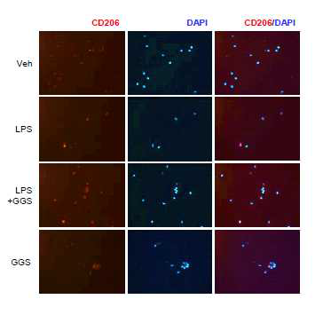 GGuggulsterone suppresses M1 markers but induces M2 markers in human monocytes. Representative images of CD206+cells (original magnification×200). Differentiated macrophages in M1 conditions were generated by treating monocytes isolated from PBMC of healthy subjects with granulocyte macrophage-colony stimulating factor (GM-CSF, 100ng/mL) for 7days. Macrophages were treated with LPS for 4 h after GGS pretreatment for 1 h and stained with immunofluorescent antibodies against CD206 (red). Figures are representative of 2 independent experiments. DAPI (blue) staining shows the nuclei. Original magnification: ×40. Veh, treated with vehicle; GGS, treated with guggulsterone (20 μM); LPS, treated with lipopolysaccharide (100 ng/mL)