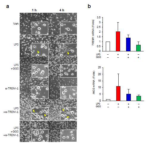 Guggulsterone suppresses M1 markers, but induces M2 markers in monocyte-derived macrophages. Differentiated macrophages into M1 conditions were generated by treating monocytes isolated from PBMC of inflammatory bowel disease (IBD) patients (a) or healthy subjects (b) using granulocyte macrophage-colony stimulating factor (GM-CSF, 100 ng/mL) for 7 days followed by treatment with LPS for 4 h with or without TREM-1 agonist antibody after GGS pretreatment for 1 h. (a) Morphology changes of macrophages derived from PBMCs of IBD patients. Arrow indicates M1-like morphology of macrophages. Figures are representative of 2 independent experiments. Original magnification: ×400. (b) mRNA expression changes of macrophages derived from PBMC of healthy subjects. Total RNA was isolated, and quantitative real-time PCR was performed using M1 markers (TREM1, iNOS). Data represent the means ± S.D. (n = 3–4). Detailed methods are described in the Methods. Veh, treated with vehicle; GGS, treated with guggulsterone (20 μM); LPS, treated with lipopolysaccharide (100 ng/mL); α-TREM-1, treated with TREM-1 agonist antibody (0.4μg/mL)