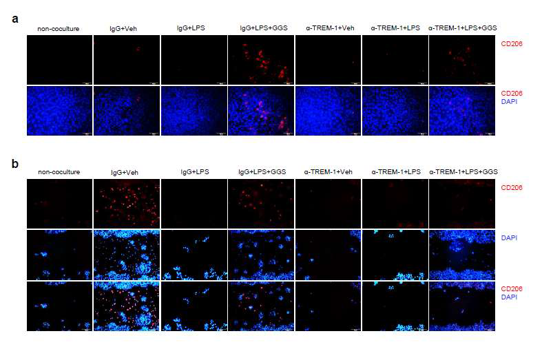 Guggulsterone promotes wound healing by M2 polarization of macrophage in IBD patients. Differentiated macrophages in M1 conditions were generated by treating monocytes isolated from PBMC of IBD patients with granulocyte macrophage-colony stimulating factor (GM-CSF, 100 ng/mL) for 7 days followed by treatment with LPS for 4 h after GGS pretreatment for 1h. (a) CD206+cellstainin HT-29 monolayer.(b)CD206+cells tainin the wound. After wound healing assay, cells were stained with immunofluorescent antibodies against CD206 (Alexa555 stained) and DAPI (blue). Arrow indicates M1-like morphology of macrophages. Figures are representative of 2 independent experiments. Original magnification: ×200. Veh, treated with vehicle; GGS,treated with guggulsterone (20μM); LPS, treated with lipopolysaccharide (100 ng/mL); α -TREM-1, treated with TREM-1 agonist antibody (0.4 μg/mL); IgG, immunoglobulin G isotype control (0.4 μg/mL)