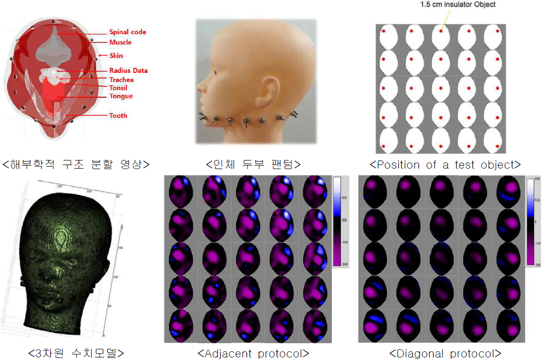 해부학적 구조 기반의 FEM 모델 및 인체 두부 팬텀 실험