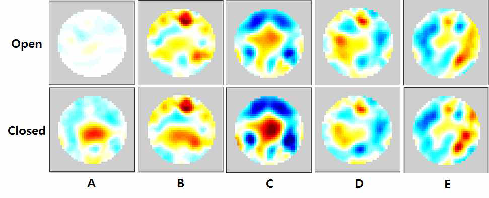 머리 움직임에 따른 도전율 단층 영상의 변화 A. neutral position; B. chin-up position; C. chin-down position; D. left-sided head rotation position; E. right-sided head rotation position