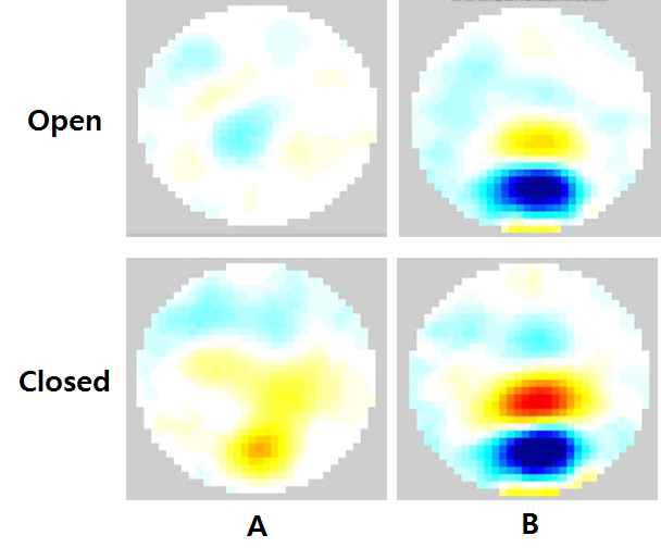 개구(mouth opening) 여부에 따른 도전율 단층 영상의 변화
