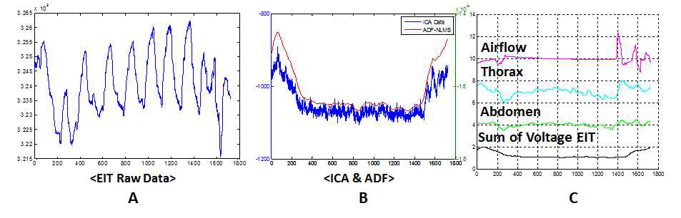노이즈 제거 알고리즘. A. 상기도의 폐쇄가 일어났을 때의 가공되지 않은 EIT 전압 데이터, B. ICA 방법을 이용한 노이즈 제거, C. 데이터 처리 된 EIT 전압데이터와 PSG 데이터간의 신호 비교