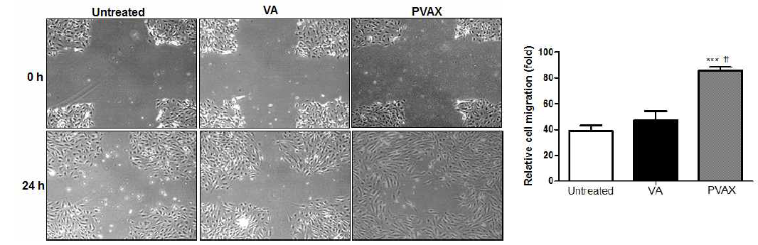 HypScratch assay를 통한 내피세포의 이동(migration)에 대한 PVAX 나노입자의 영향평가