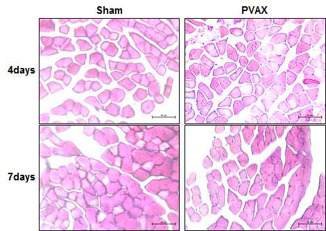 PVAX 나노입자를 주사한 후 대퇴근육조직의 H&E 염색 사진