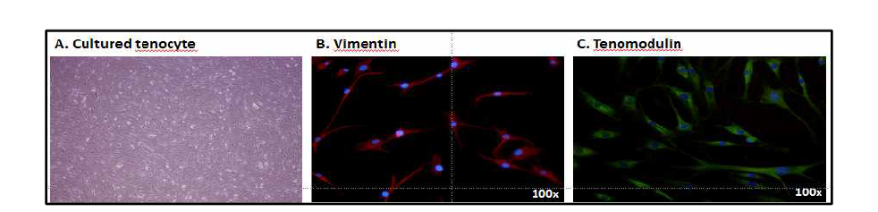 배양된 건세포와 immunohistochemisty 결과. 채취된 조직을 이용하여 건세포 배양을 실시하였고, 건세포 확인을 위해 마커인 vimentin (red, B)과 tenomodulin (green, C)에 대해 immunohistochemisty를 시행한 결과 배양된 세포의 88% (vimentin), 90% (tenomodulin)에서 발견됨