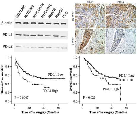 다양한 간암세포주 및 간암 조직에서 PD-L1이 과발현 되어있으며 간암 조직 내 PD-L1 발현이 높은 환자군에서 생존률이 유의하게 낮음