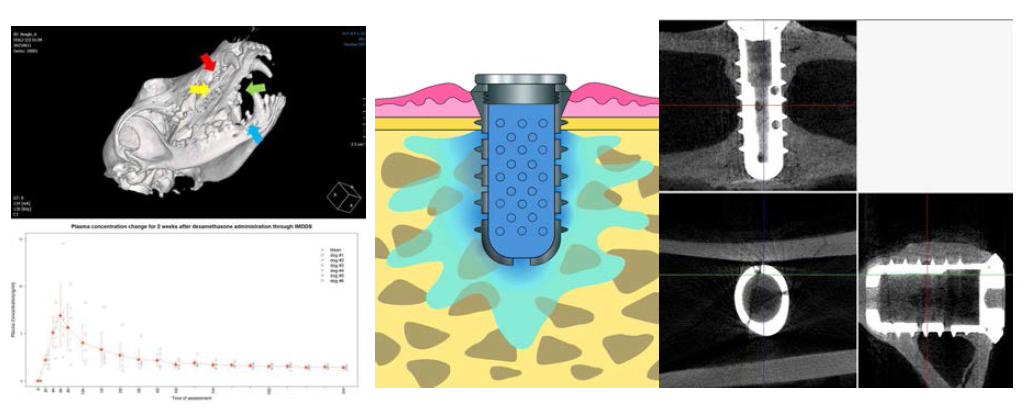 비글 구강내의 다양한 위치에 IMDDS 식립된 CT 사진과 Dexamethasone의 release profile, Micro CT 상에서 IMDDS의 골/골수 접촉양상