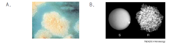 결핵 및 비결핵항산균의 집락 표현형 A. 결핵균의 집락 표현형 (rough) B. 비결핵항산균 인 M. abscessus의 서로 다른 집락 표현형 (좌: smooth, 우: rough)