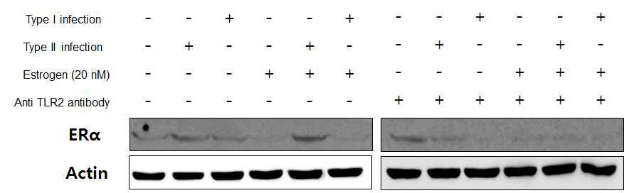 에스트로겐 및 anti-TLR2 antibody의 유무에 따라 마크로파지 (J774)에 M. massiliense 균주 50594 (rough, Type II) 와 51843 (smooth, Type I) 감염 시 (10 M.O.I.), 에스트로겐 리셉터 (estrogen receptor α, ER-α)의 발현량 차이를 western blot을 통해 확인