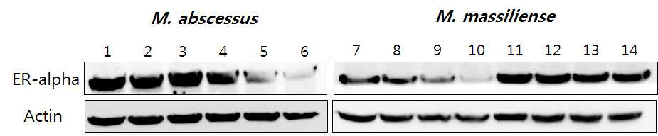 M. abscessus 및 M. massiliense 임상 분리 균주 (rough 및 smooth 균주)를 고압 증기 멸균법을 통해 불활화 시킨 후 J774 세포주에 감염시킴. 감염 18 시간 후에 세포로부터 단백을 추출하여 ER-α 및 actin에 대한 western blot을 수행함. Lane 1, 58582 strain (smooth); lane 2, 58584 strain (smooth); lane 3, 58321 train (smooth); lane 4, 58188 strain (rough); lane 5, 51830 strain (rough); lane 6, 58816 strain (rough); lane 7, Asan 7 strain (smooth); lane 8, Asan 15 strain (smooth); lane 9, Asan 30 strain (smooth); lane 10, 51843 strain (smooth, Type I); lane 11, Asan 4 strain (rough); lane 12, Asan 38 strain (rough); lane 13, Asan 19 strain (rough); lane 14, 50594 strain (rough, Type II)