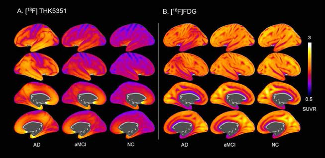 알츠하이머치매, 기억형경도인지장애, 정상대조군에서 THK5351 PET과 포도당 PET의 average map