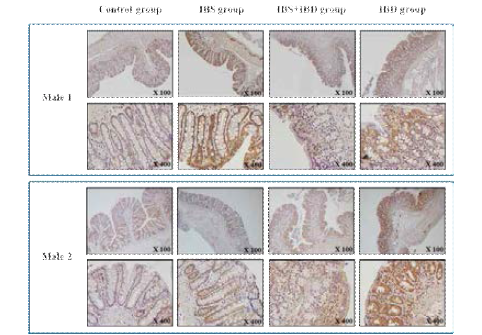 Heat shock protein 90 면역조직화학염색결과 (수컷)