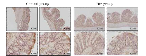 Heat shock protein 70 면역조직화학염색결과 (암컷)