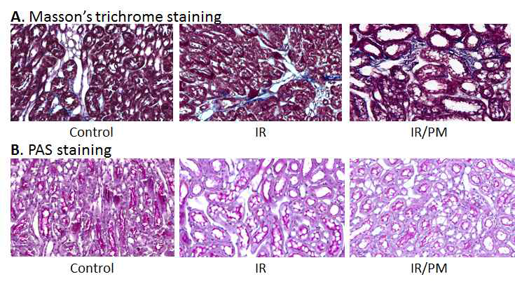 Kidney IR injury 모델과 pyridoxamine 처리에 따른 kidney outer medulla에서의 histology 변화