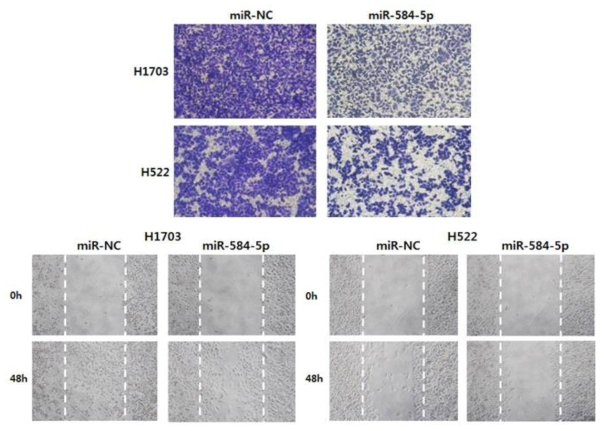 H1703과 H522 세포주에서 miR-584-5p의 발현에 따른 세포 침윤 및 이주 능력 차이