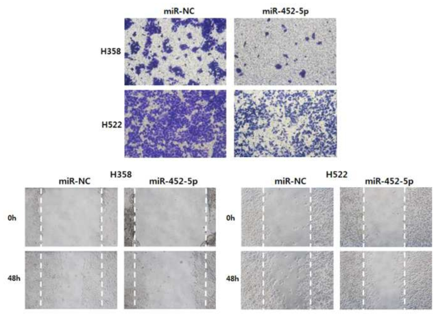 H522와 H358 세포주에서 miR-452-5p의 발현에 따른 세포 침윤 및 이주 능력 차이