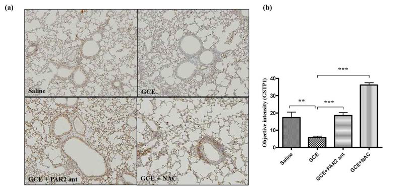 PAR2 Ab와 NAC에 의한 GSTP1 발현 양의 변화