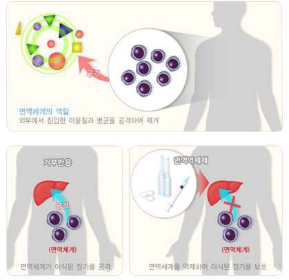 이식거부반응과 면역억제제