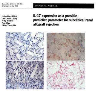 IL-17과 subclinical rejection의 연관성