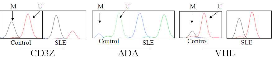 CpG island methylation 정도를 측정 하기 위한 MSBE 방법의 예. CD3Z, ADA, VHL의 유전자에 대한 MSBE 방법으로 SLE 환자와 대조군에서 측정한 예를 제시하였음. Methylation level은 methylated strand에서오는 신호인 M의 peak height를 unmethylated strand에서오는 신호인 U의 peak height로 나누어 분석에 사용하였다