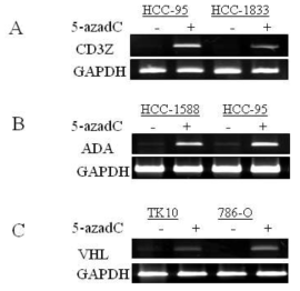 CD3Z, ADA, VHL의 promoter methylation과 유전자 발현의 상관관계. Demethylating agent인 sodium azadeoxycytidine을 각각 두 가지의 세포 주에 처리하고 난후 cDNA를 합성하였다. 각각의 유전자에 대한 PCR primer를 사용하여 demethylating agent를 처리한 세포와 처리하지 않은 세포에서 세 가지 유전자의 발현을 확인하였는데, 모든 유전자의 발현이 demethylating agent를 처리한 모든 세포 주에서 증가한다는 것을 확인하였다. 이때 대조유전자로 GAPDH를 사용하였다