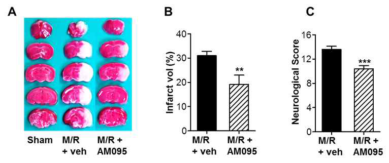 AM095를 활용한 허혈성뇌졸중(M/R)의 뇌손상과 LPA1 활성화의 상관성 규명